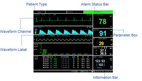 Patient Monitor Model: UD-630x 500X500