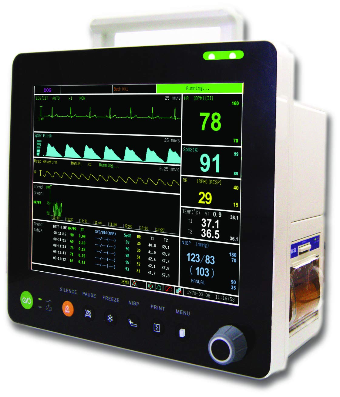 Patient Monitor Model: UD-630x 500X500